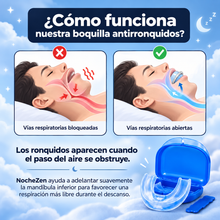 NocheZen® Protector Bucal Antirronquidos para Noches Más Tranquilas